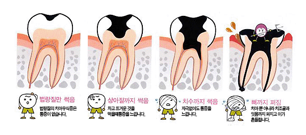 e-플랜트치과 이미지