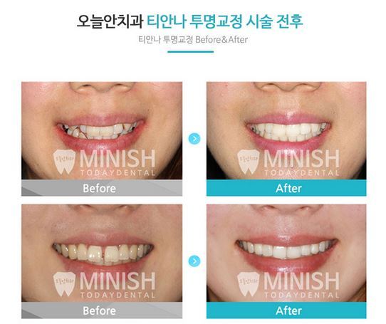 티안나 이미지