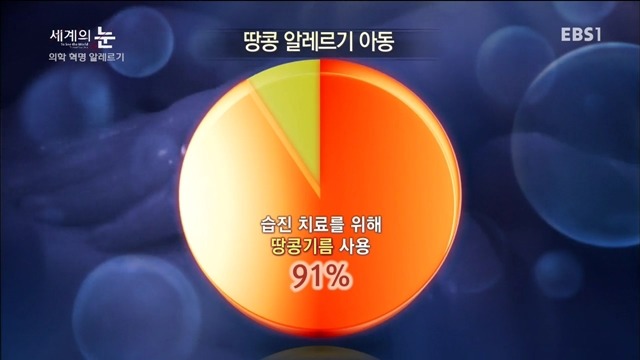 다큐 세계의 눈 - 의학 혁명 알레르기 | 인스티즈