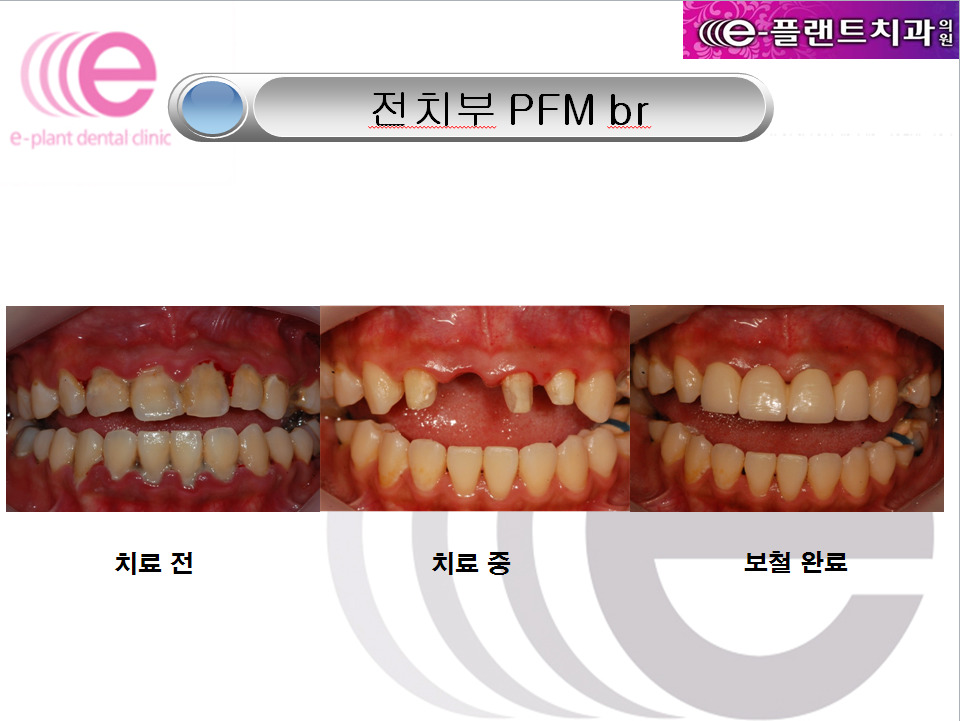 e-플랜트치과 이미지