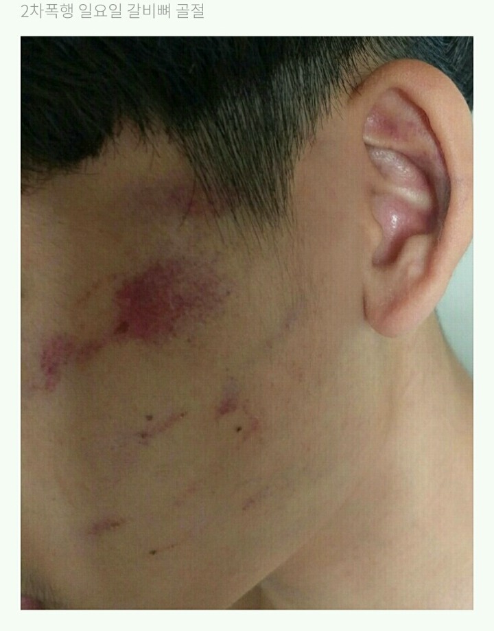 저희 아들이 집단 폭행을 당했습니다 jpg | 인스티즈