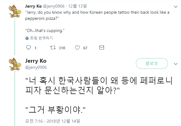 한국사람들은 왜 등에 페퍼로니 문신을 해?.jpg | 인스티즈